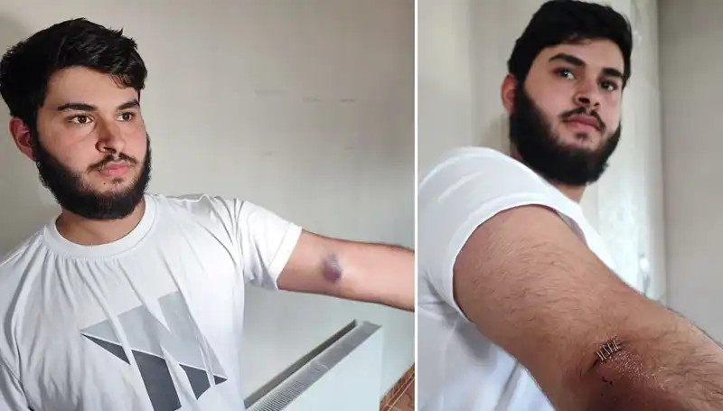 Bahçeye Kaçan Top Mahallede Heyecan Yarattı: "Conolar Kamyonetle Geldi"